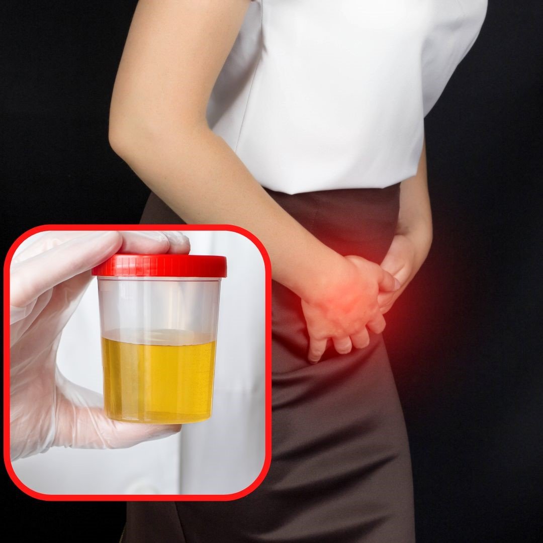 Urine Infection Treatment Delhi