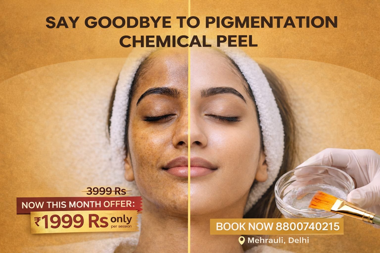 Chemical peel treatment in Delhi showing improved skin brightness and glow