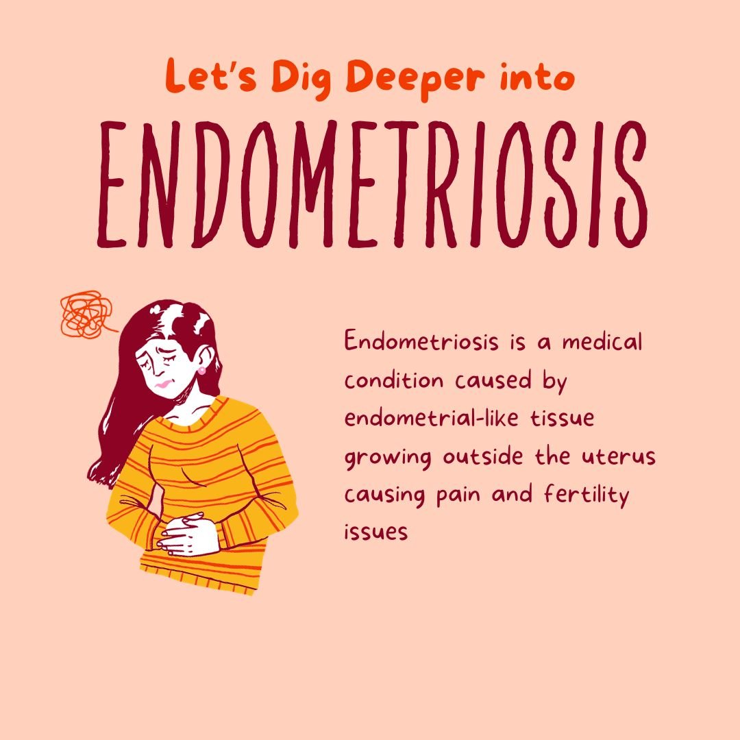 Endometriosis in Women