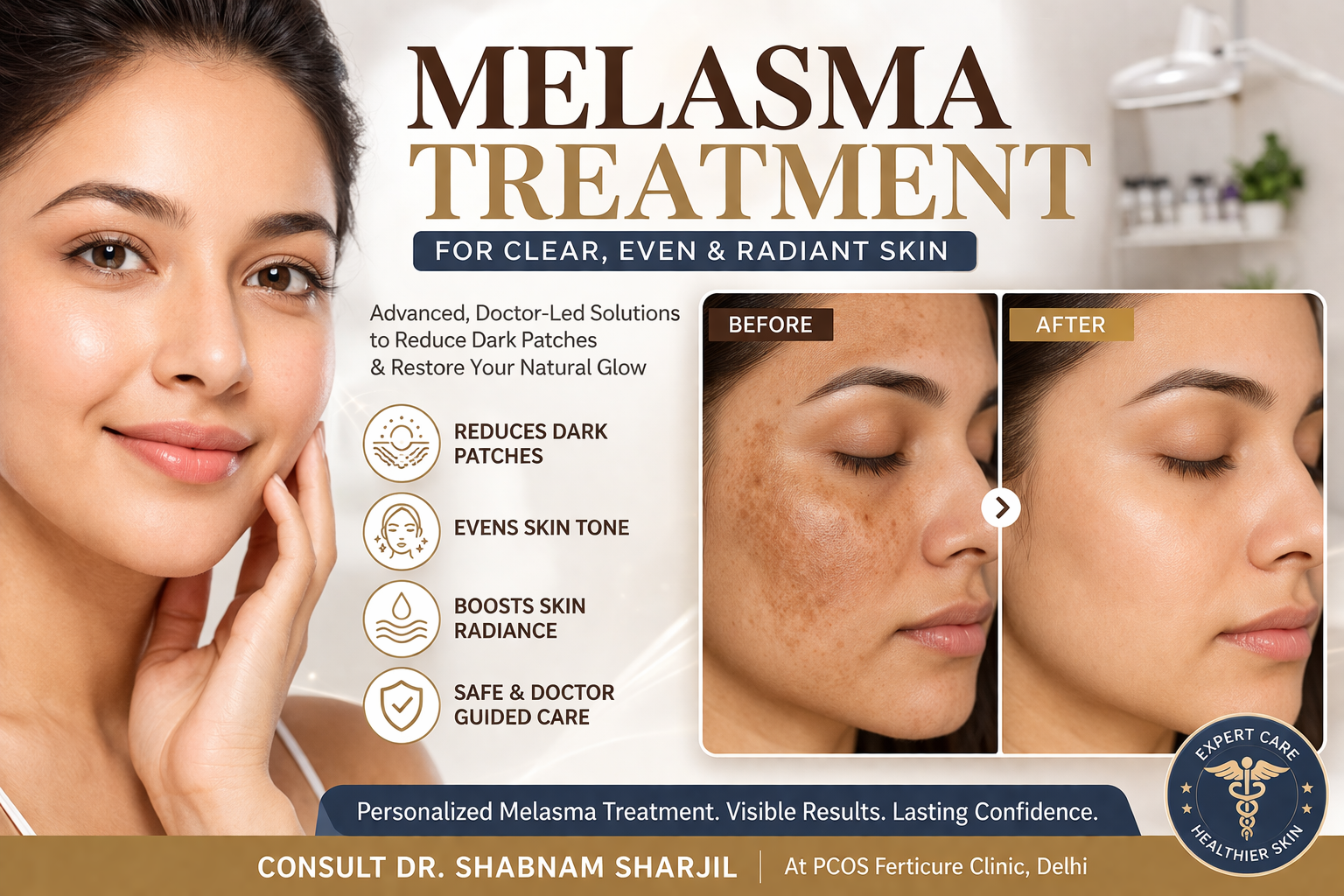 PRP facial treatment procedure in Delhi showing platelet-rich plasma syringe, centrifuge machine, and facial injection process at PCOS Ferticure Clinic