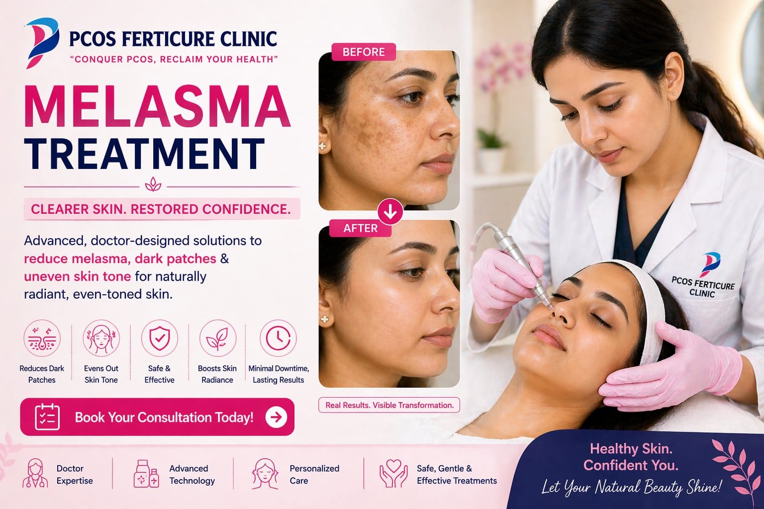 Melasma pigmentation treatment Delhi