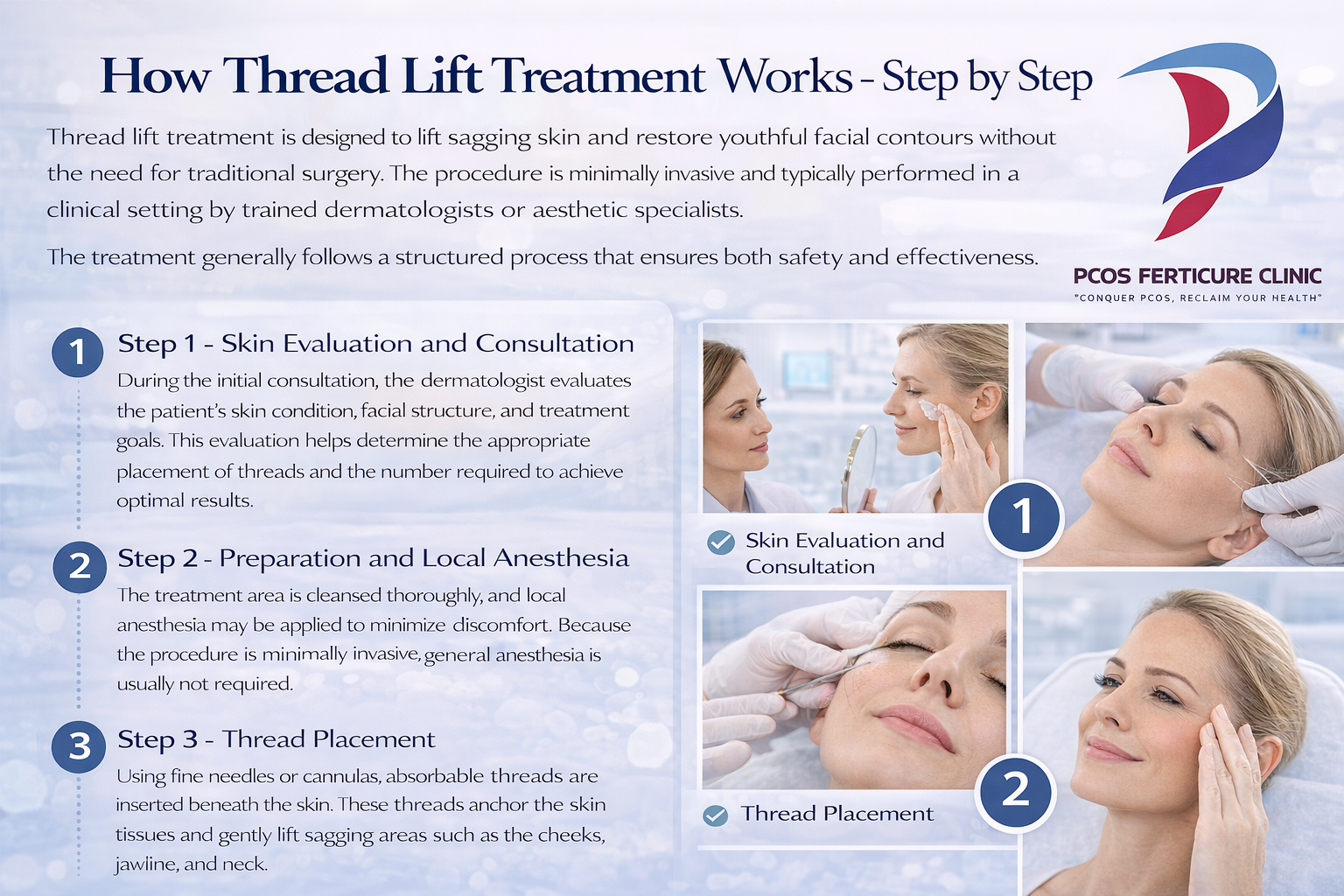 Step by step thread lift treatment procedure