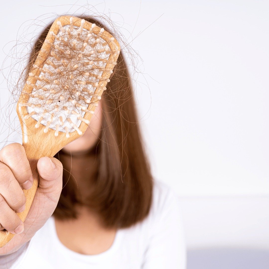 PCOD Blog Image - Addressing PCOS and Hair Loss: Expert Insights and Strategies by Dr. Shabnam Sharjil at PCOS Ferticure Clinic.