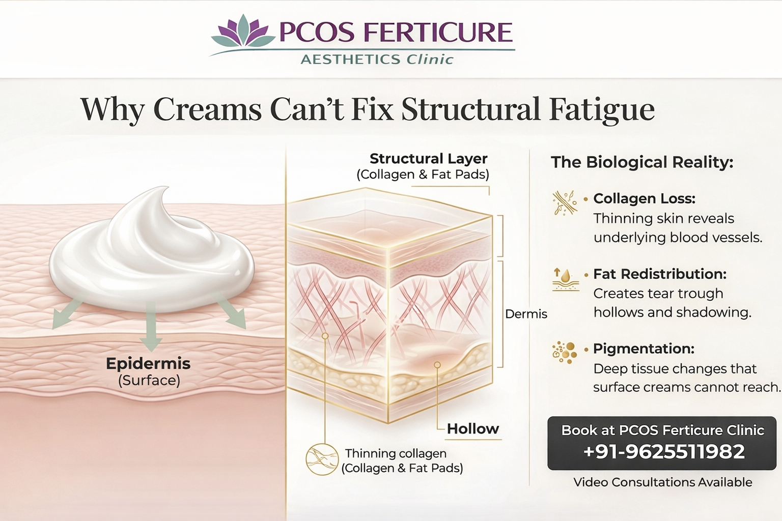 PRP Therapy for Under-Eyes in Delhi