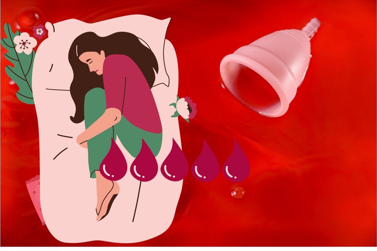 Addressing Heavy Periods in Endometriosis - Dr. Shabnam Sharjil at PCOS Ferticure Clinic discusses heavy periods associated with endometriosis. Explore expert insights, tips, and effective strategies for managing heavy menstrual flow within the context of women's health and endometriosis.