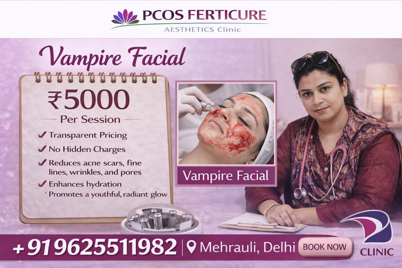 PRP facial treatment procedure in Delhi showing platelet-rich plasma syringe, centrifuge machine, and facial injection process at PCOS Ferticure Clinic