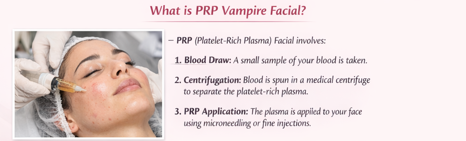 PRP facial treatment in Delhi showing platelet rich plasma application on face